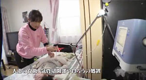医療処置（胃ろう）